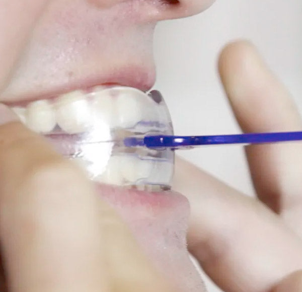 Anti-snurkbeugel voor mannen | Snoremeds